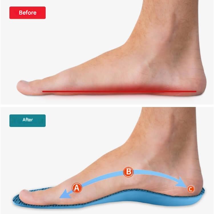 Orthopaedic Insoles – StepRelief-4-5.5-The Livary