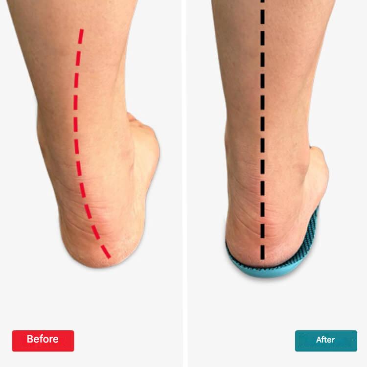 Orthopaedic Insoles – StepRelief-4-5.5-The Livary