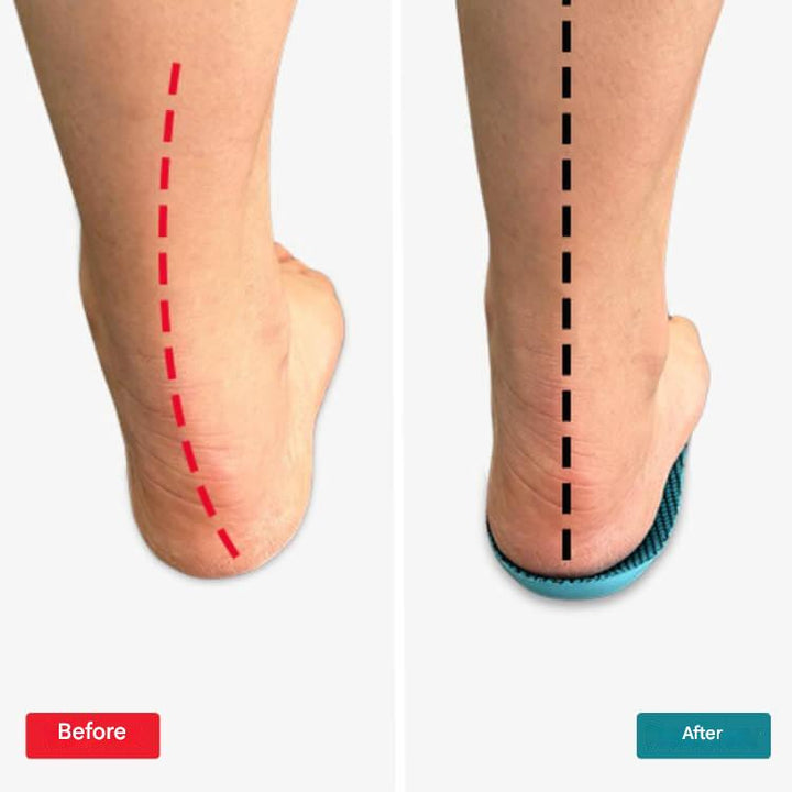Orthopaedic Insoles – StepRelief-4-5.5-The Livary