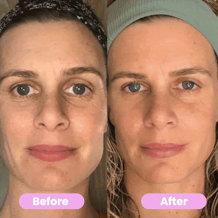 7-in-1 LED Face Firming & Massage Tool – Vénera-White-The Livary